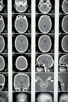 Comprehensive set of brain MRI scans highlighting cranial anatomy for medical use.